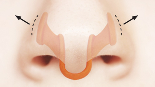 Picture of AirMax Nasal Dilator