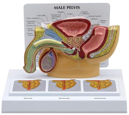 Picture of Male Pelvis with 3D Prostate Frame