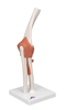 Picture of Anatomical Model - Elbow