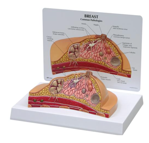 Picture of Breast Cross-Section Model