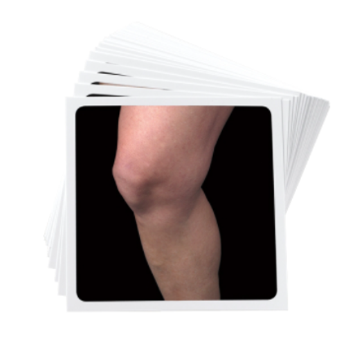 Picture of NOI Recognise™ Knee Flash Cards