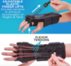 Picture of Radial Nerve Palsy Splint | Dynamic Wrist Drop & Finger Extension Brace for Saturday Night, Honeymoon & Crutch Palsy