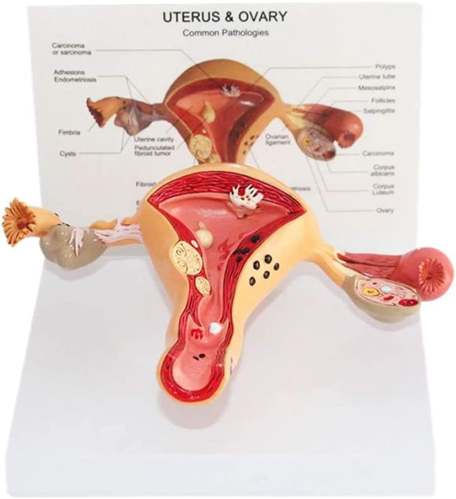 Picture of Uterus-Ovary Model
