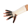 Picture of Hand-Based & Forearm-Based Radial Nerve Splints